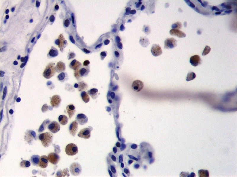 Toxoplasma-gondii.jpg