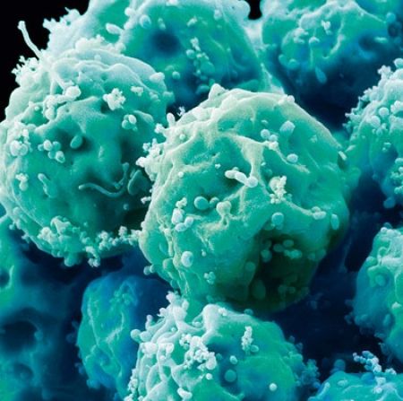 Cancer-stem-cells.jpg