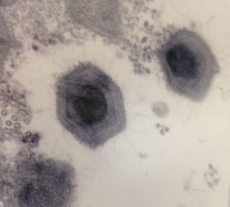 The-Hexagonal-forms-of-the-Mimivirus.jpg
